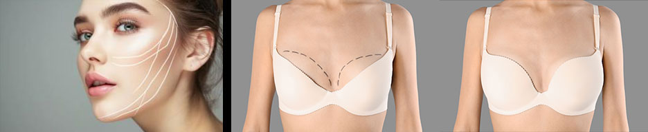 美しい輪郭を造形する美容溶解&脂肪増強