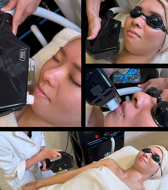 GRAND IPL Premium Machine KIWAMI 最先端のマシーンで、美肌を叶える 日本人向けに開発されたMADE IN JAPANのIPLマシーン